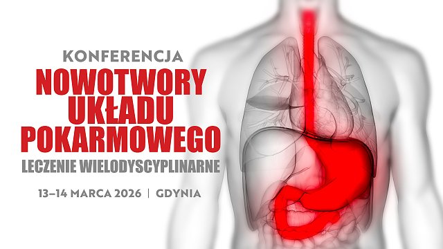 Nowotwory układu pokarmowego – leczenie wielodyscyplinarne